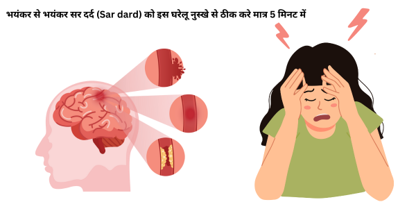 भयंकर से भयंकर सर दर्द (Sar dard) को इस घरेलू नुस्खे से ठीक करे मात्र 5 मिनट में